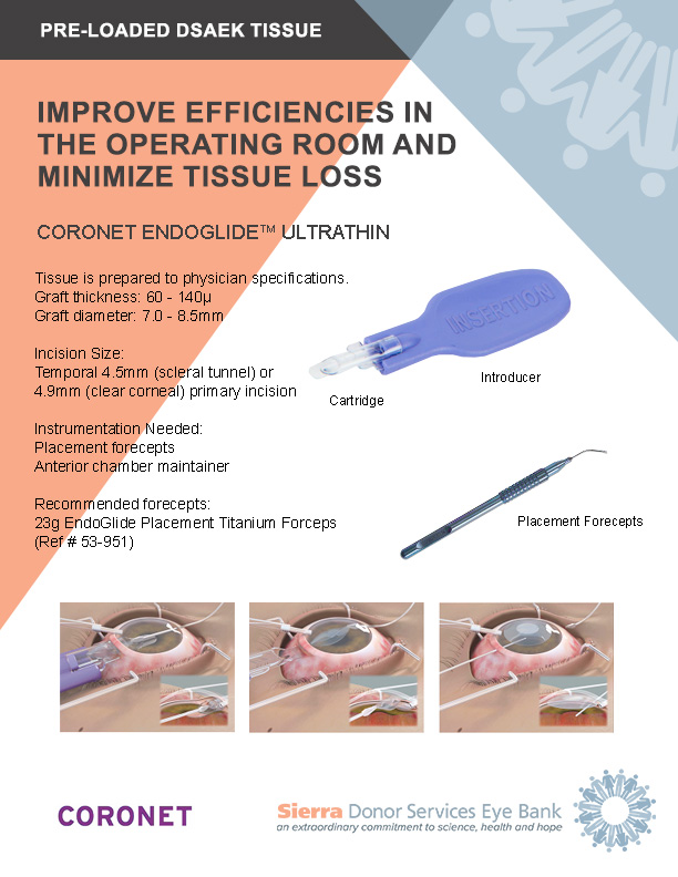 Descemet Stripping Automated Endothelial Keratoplasty (DSAEK) - SDS Eye ...